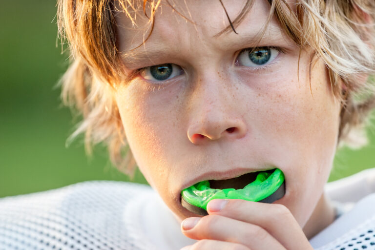 mouth guards